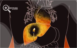 Doença Cardiovascular em Pacientes com Hepatite C