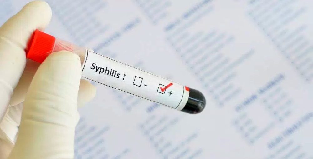Diagnóstico da Sífilis