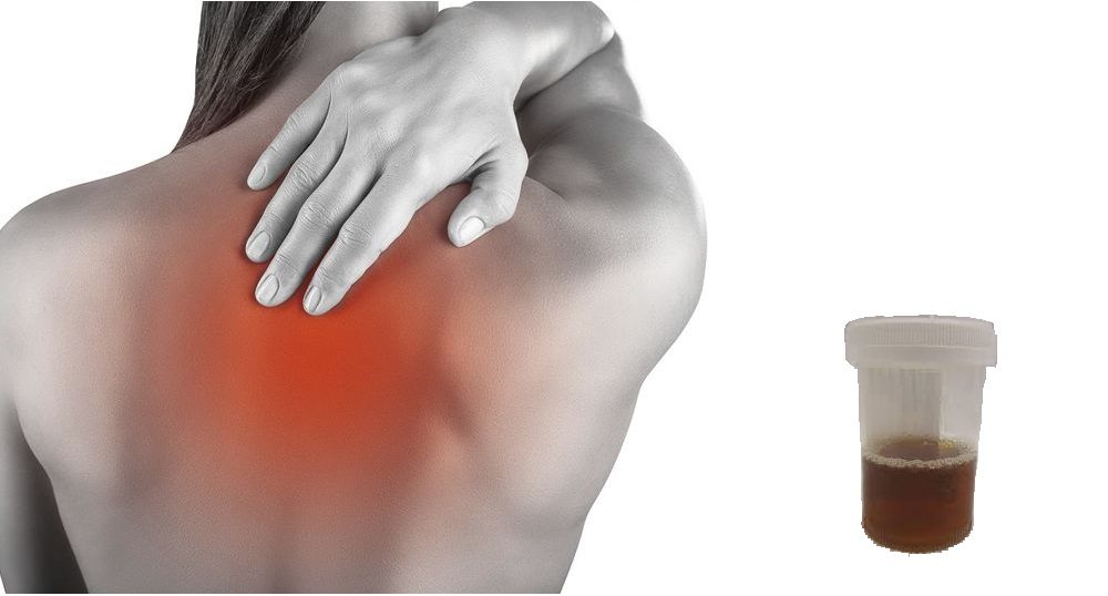 mialgia aguda a esclarecer