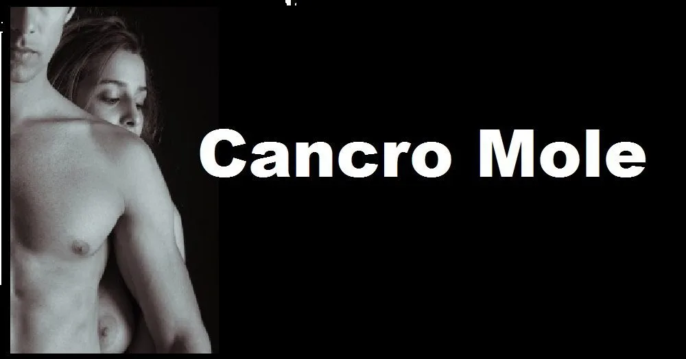 cancro mole ou cancroide