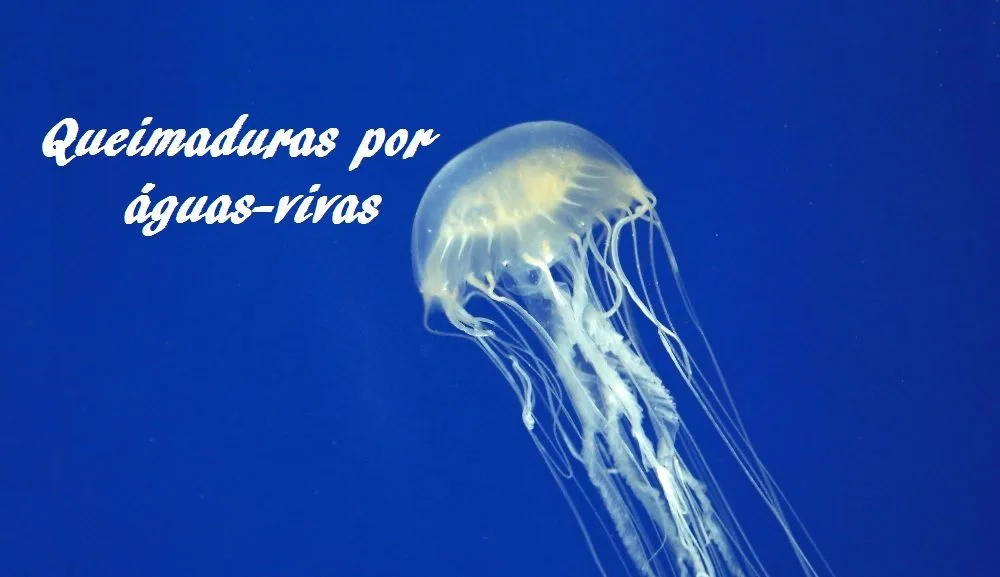 Queimaduras por águas-vivas e caravelas