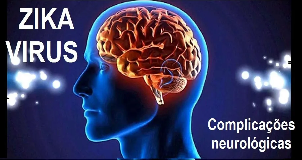 Complicações neurológicas do Zika