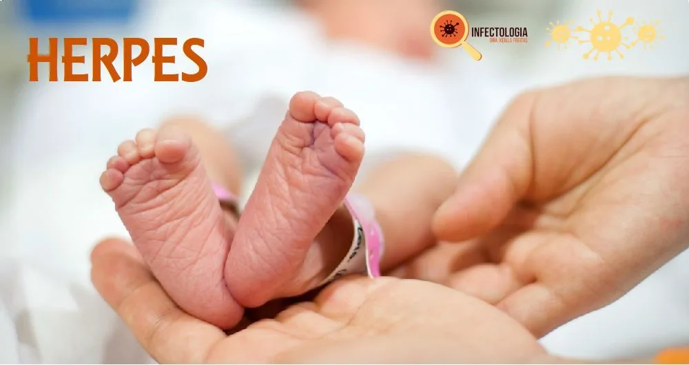 Herpes gestacional e herpes neonatal
