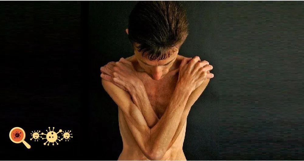 Perda de peso em pacientes com HIV