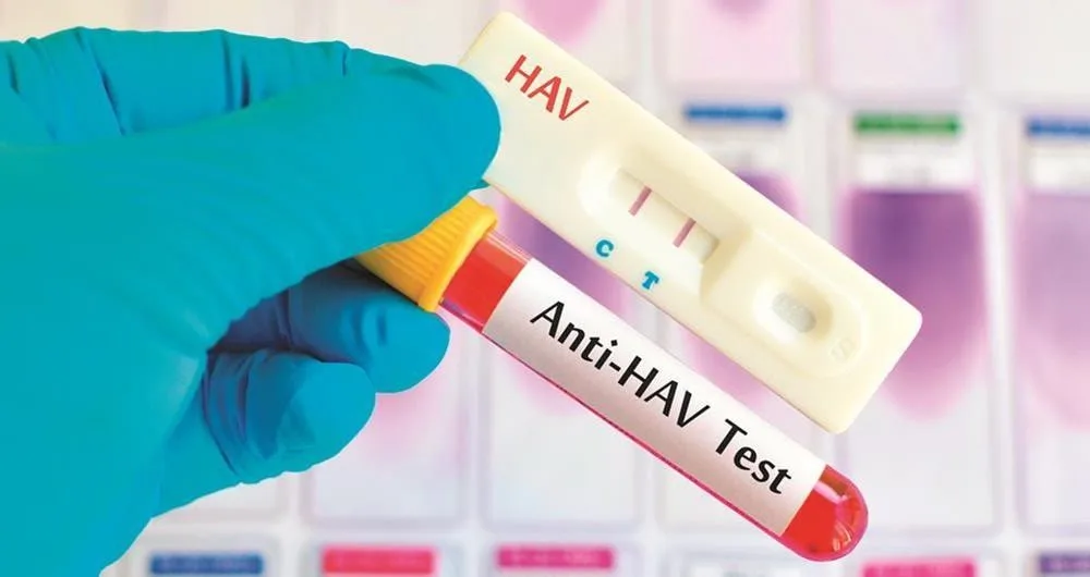 Hepatite A: O que você precisa saber