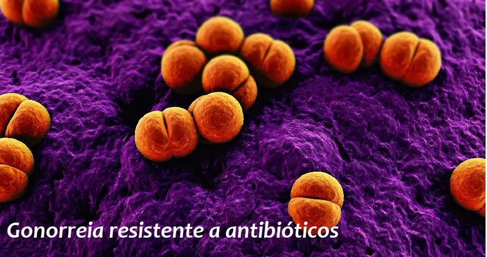 Resistência de gonococo no Rio de Janeiro