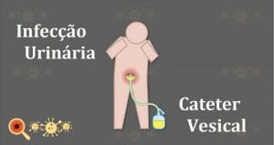 Infecção urinária associada a sonda vesical