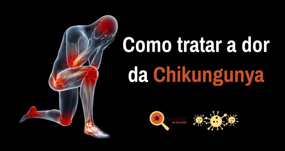 Como tratar a dor da Chikungunya