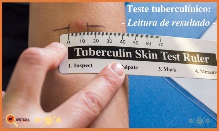 Diagnóstico Da Tuberculose