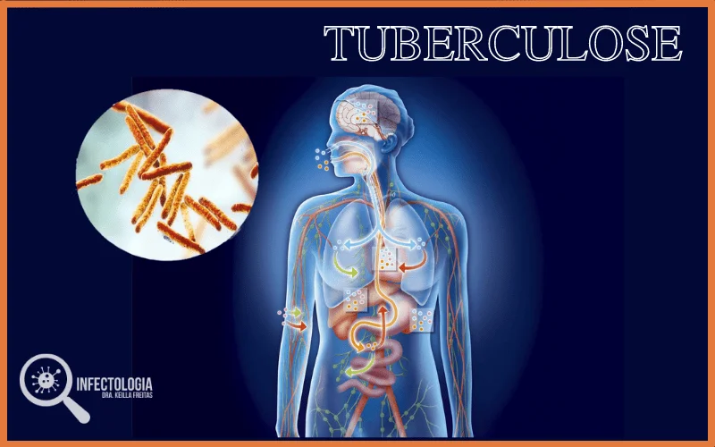 Sintomas da Tuberculose
