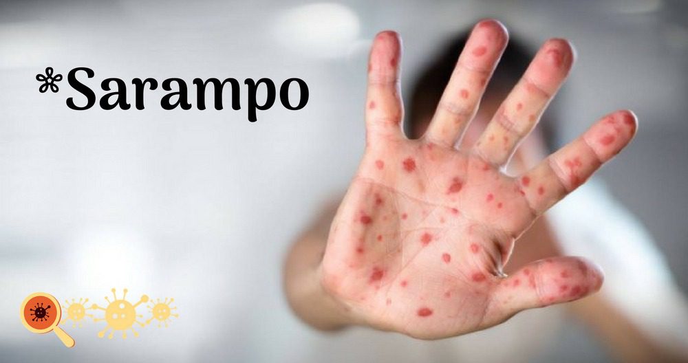 Sarampo Capa Saiba Mais