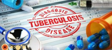 A Tuberculose é uma doença infecciosa ainda muito prevalente no mundo.
