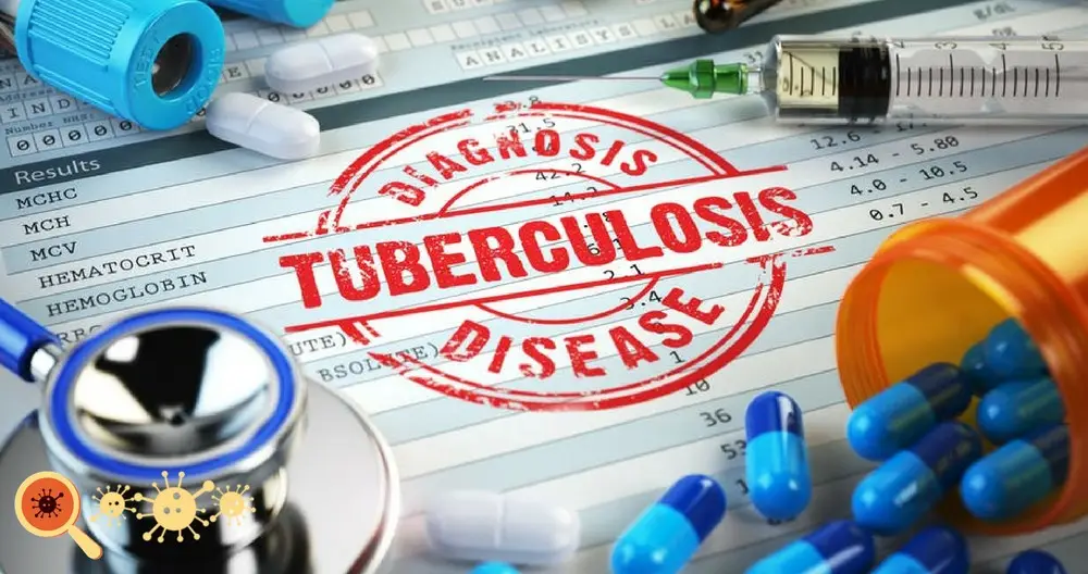 A Tuberculose é uma doença infecciosa ainda muito prevalente no mundo.