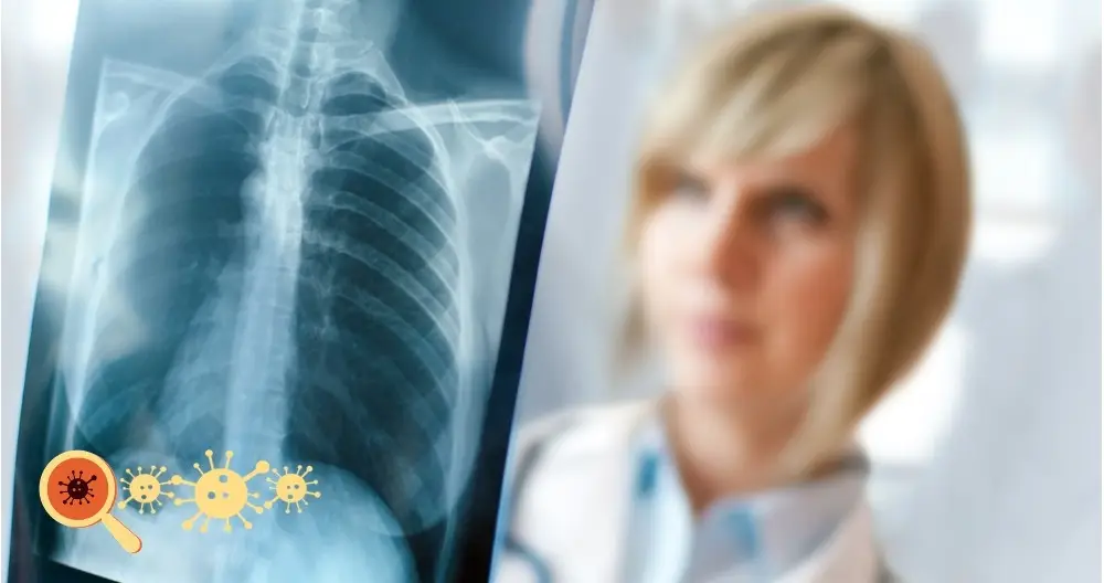 Benzodiazepínicos e Pneumonia