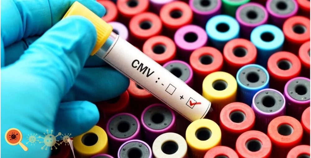 Citomegalovírus ou CMV