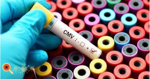 Citomegalovírus ou CMV