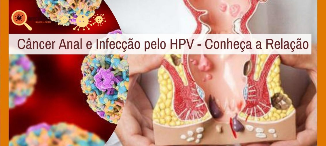 Câncer Anal e Infecção pelo HPV