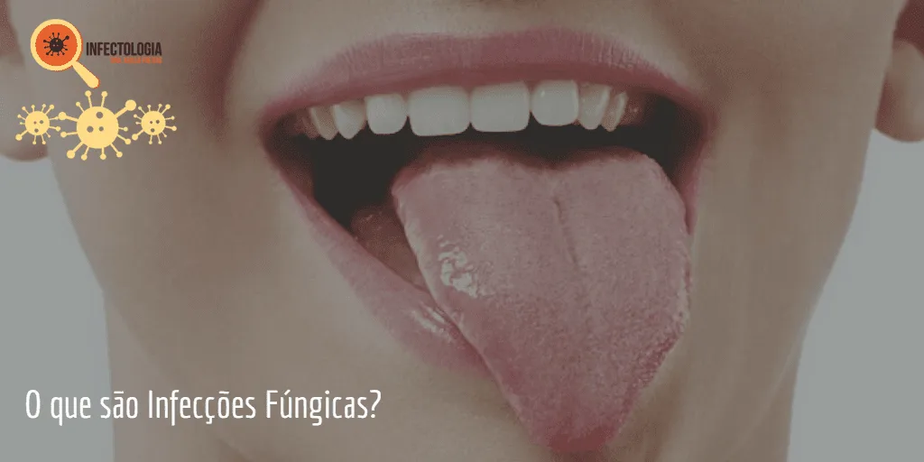 infeccoes-fungicas