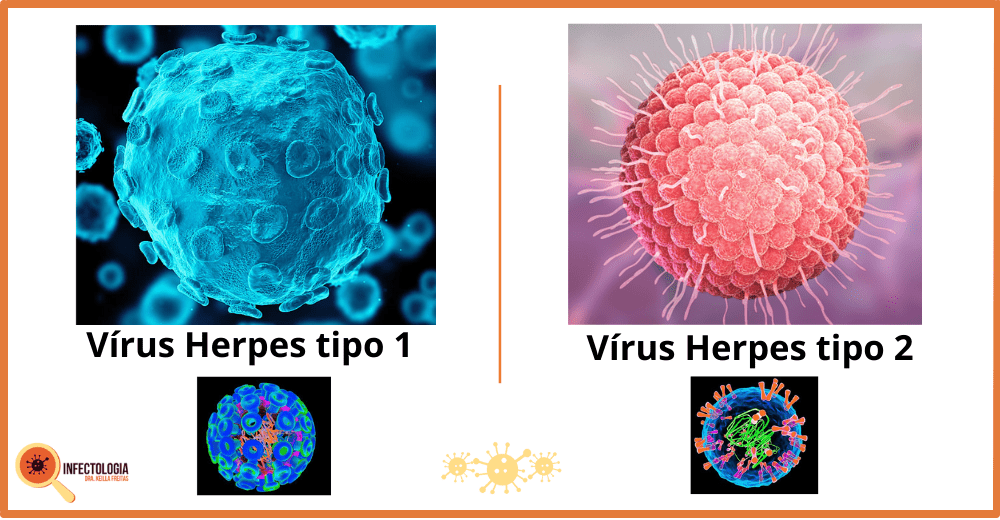 Vírus Herpes Simples Tipo 1 e 2