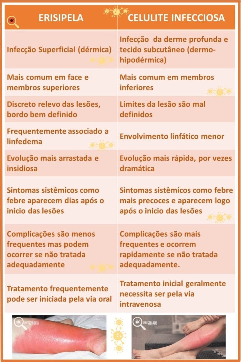 Erisipela ou Celulite Infecciosa: Conheça A Doença | Dra. Keilla ...