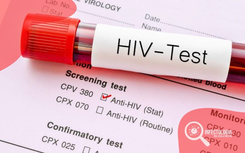 Diagnóstico do HIV: Como Fazê-lo