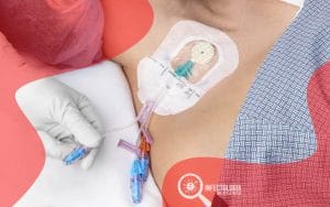 Infecção associada a Cateter Venoso